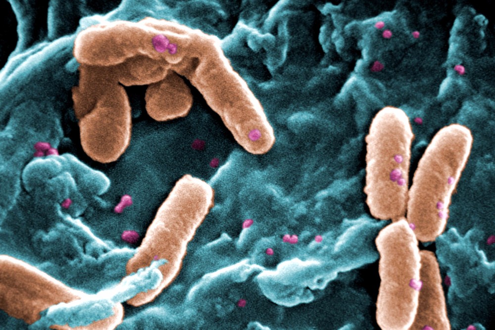 ALERTĂ medicală în Europa. O ciupercă mortală se răspândește în spitale din 40 de țări. Ce se știe până acum