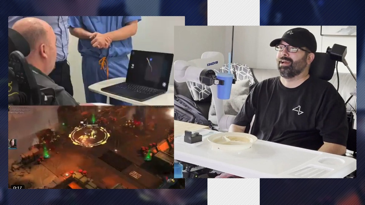 Compania Neuralink a ajuns să implanteze cipuri cerebrale. Cum a transformat un creier uman într-un adevărat joystick