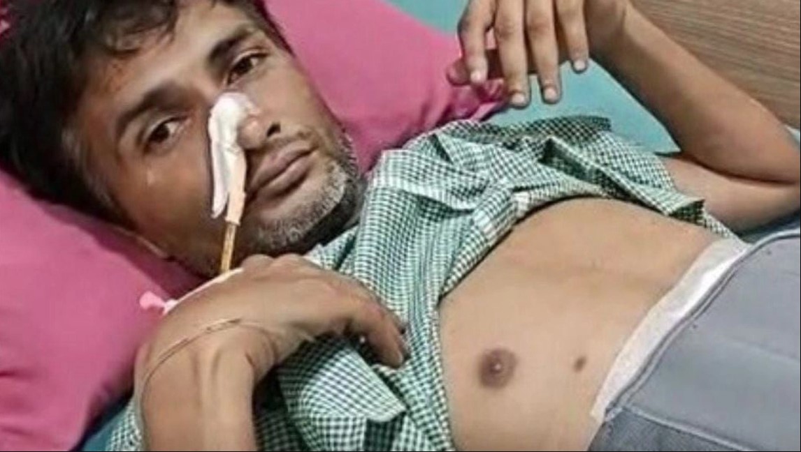 Ce au descoperit medicii în stomacul unui bărbat. Acesta s-a prezentat la urgențe cu dureri mari abdominale