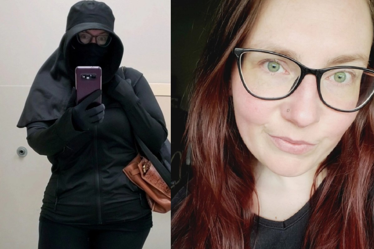 Femeia-vampir există: nu poate rezista la soare mai mult de câteva secunde. Boala rară de care suferă o tânără din SUA