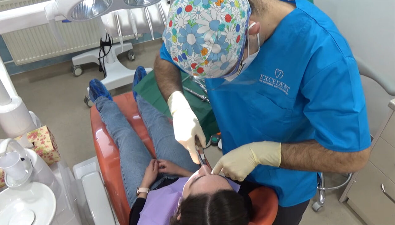 Cât costă să scoți o măsea cariată în 2026. Câți bani cer medicii stomatologi în România