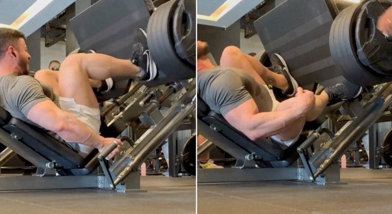 Un culturist a ajuns ajuns pe masa de operație după un exercițiu de forță cu 400 de kilograme