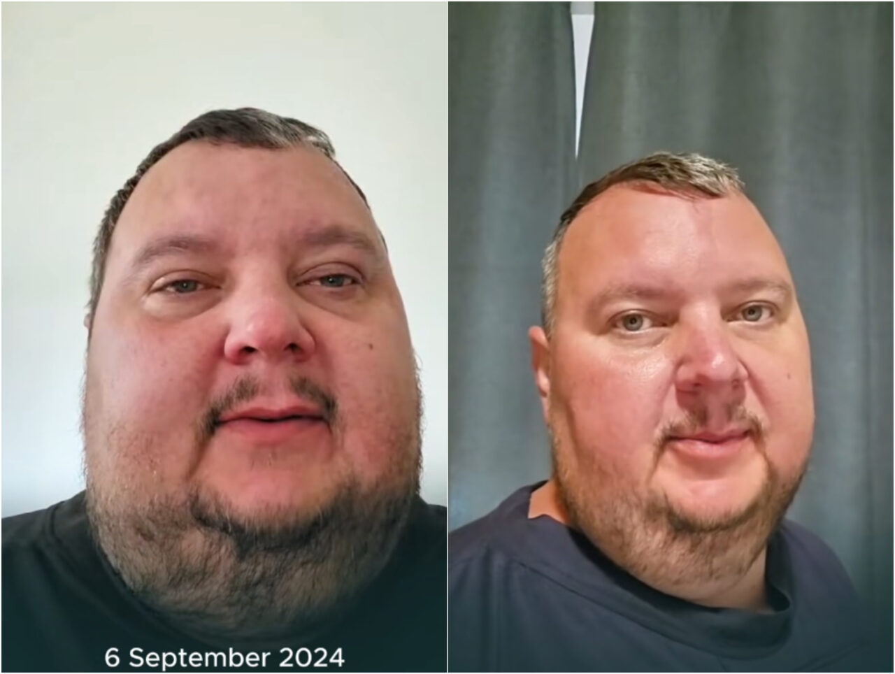 Transformarea ireală a unui bărbat din Marea Britanie. Obișnuia să bea 12 litri de Cola și să mănânce 2 pâini pe zi. Cum arată după ce a slăbit 187 kg