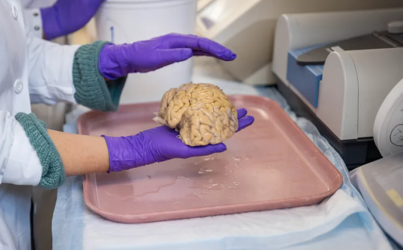 Studiu. Oamenii se știință au descoperit o cheie pentru ca oamenii să rămână ageri la minte la senectute. Secretul „SuperAgers”, parțial elucidat