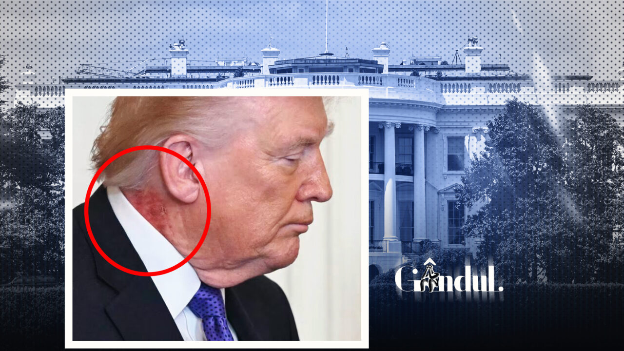 Ce se întâmplă cu pielea lui Donald Trump. Medicul său a venit cu explicații după ce imaginile au devenit virale