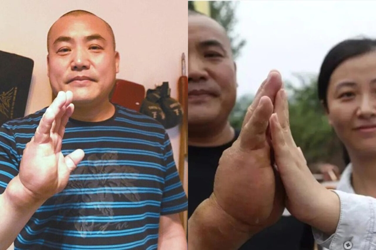 Motivul pentru care Zhang are palme groase de 8 centimetri. Antrenamentul și-a pus amprenta asupra fizicului său