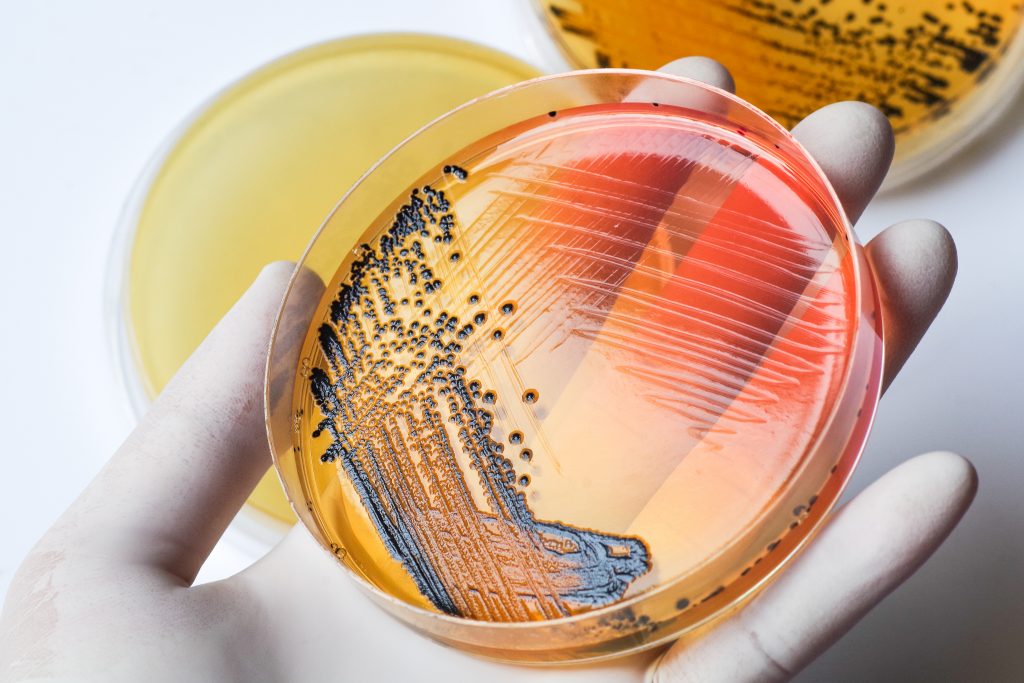 ALERTĂ SANITARĂ! O bacterie rară, „mâncătoare de carne”, se răspândește în Japonia. Poate provoca moartea în mai puțin de 48 de ore!