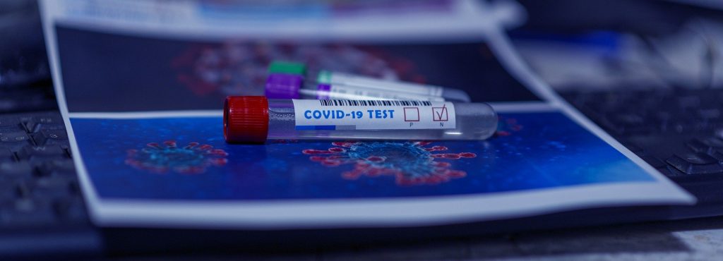 Raportarea testelor rapide pentru COVID-19, obligatorie în România! Când intră în vigoare decizia