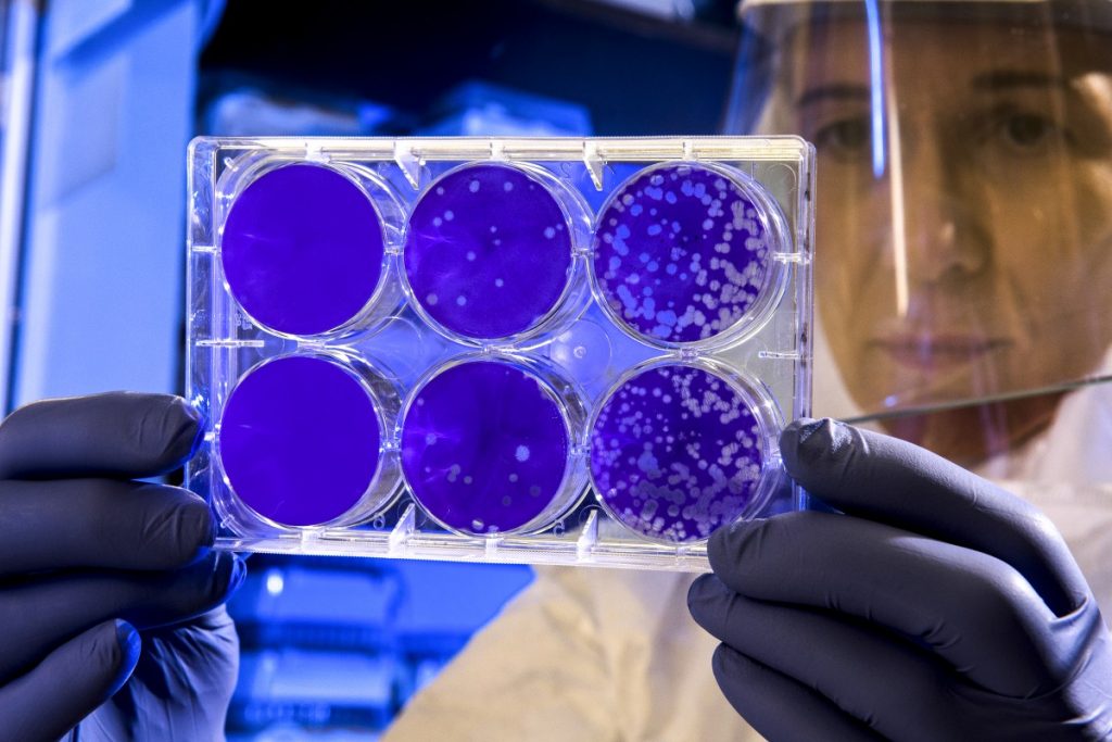 Studiu Covid-19. Persoanele infectate au imunitate la noul coronavirus cel puțin 8 luni!