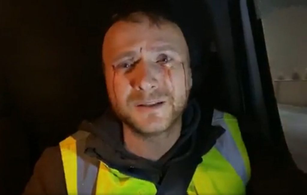 Imagini de coșmar: Activist de mediu, atacat și lovit cu pietre de hoții de lemne: „Criminali odioși!” (VIDEO)