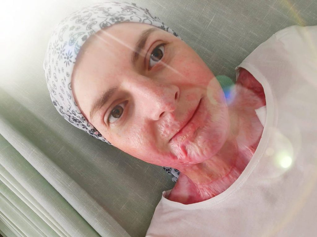 Fata din Mehedinți incendiată de Ion Turnagiu, criminalul eliberat condiționat, mesaj emoționant în Ajunul Crăciunului: “Datorită vouă, oameni minunați, sunt bine!”