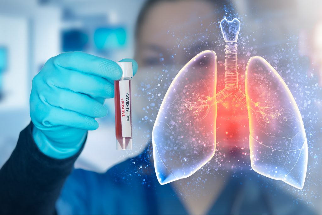 Studiu: Pneumonia COVID-19 este mai mortală deoarece se răspândește ca „focul”