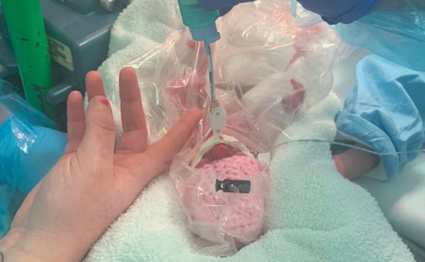 Un bebeluș născut prematur a supraviețuit ca prin minune! Medicii au folosit o metodă neobișnuită: punga de sandvici