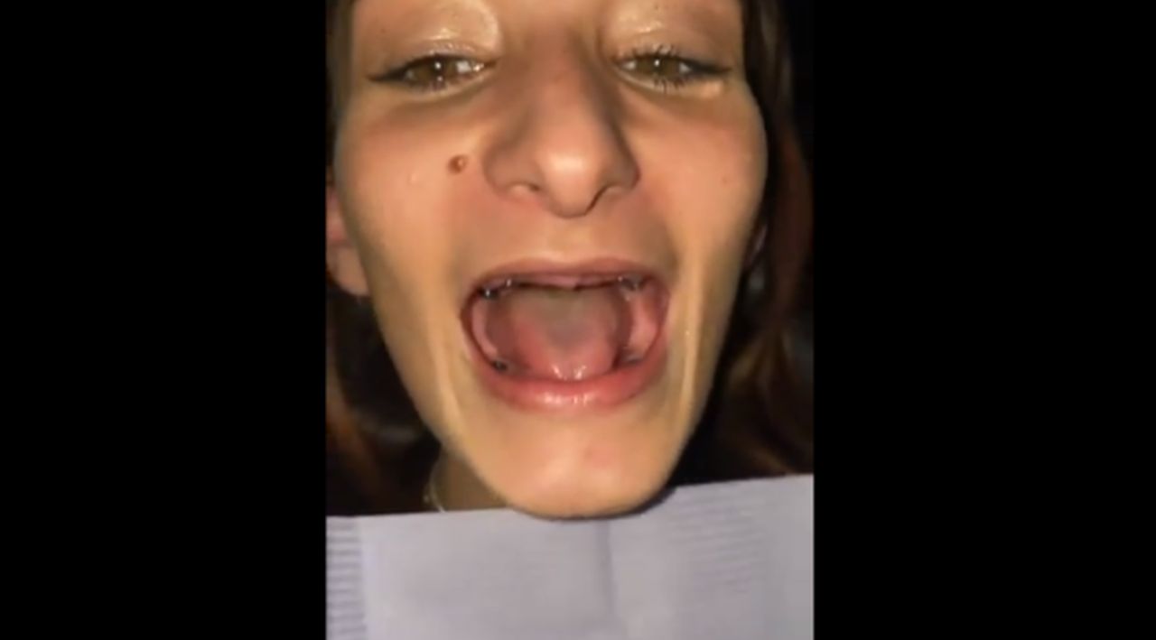 Dentistul groazei: I-a scos toți dinții din gură unei paciente! Cum arată tânăra după ce a primit o dantură nouă (VIDEO)