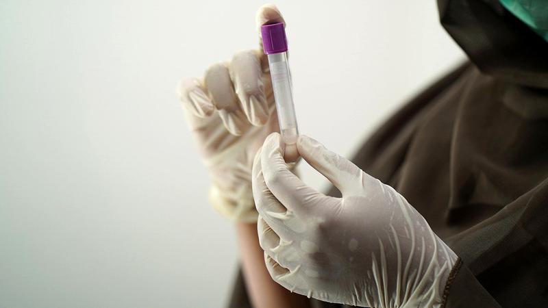 Coronavirus în România. Bilanț 11 aprilie 2021: Peste 3.000 de noi cazuri de persoane infectate cu SARS-CoV-2. Record absolut la ATI