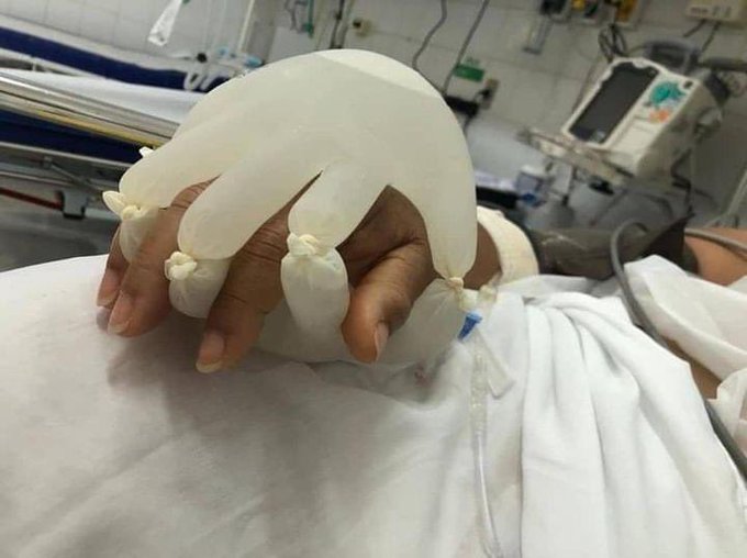 „Mâna lui Dumnezeu”. Asistenții medicali din Brazilia au venit cu o idee inovatoare pentru pacienții izolați la ATI. Fotografia a devenit virală