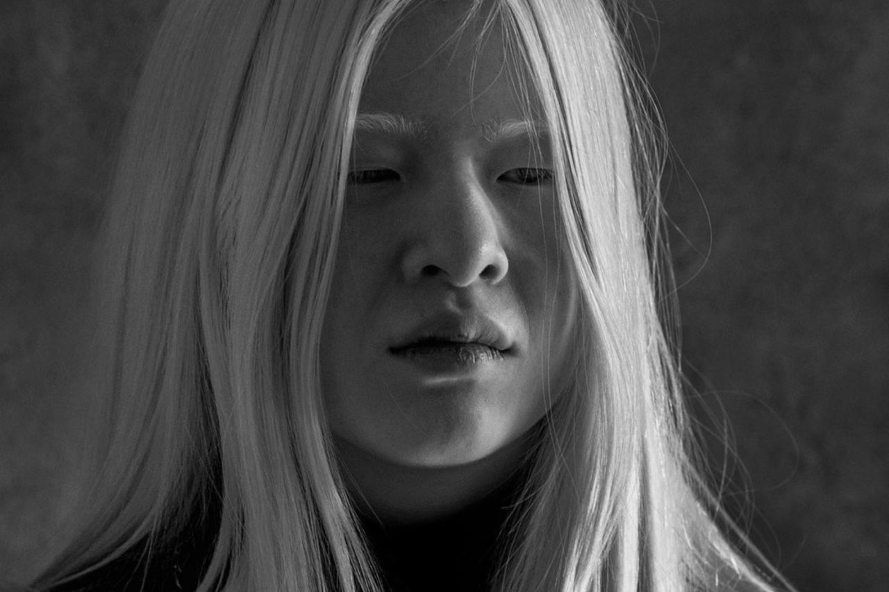 Bebelușul abandonat care a devenit model Vogue. Povestea impresionantă a lui Xueli Abbing, bolnavă de albinism – FOTO