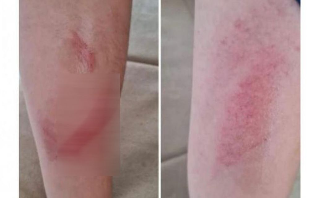 Elev agresat de colegi pentru că este „grăsuț”. Incidentul revoltător, cercetat de Poliție și Inspectoratul Școlar Județean Gorj