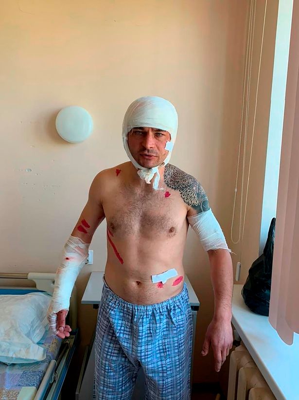 Pescar scalpat de un urs pe Insula Sahalin. Bărbatul a făcut pe „mortul” și apoi a condus șase kilometri până la spital