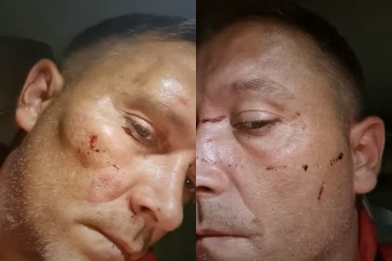 Bărbat, bătut cu bestialitate de trei indivizi când se întorcea de la un priveghi: „Siguranţa nu mai există”. Ce transmit autoritățile în urma atacului – VIDEO