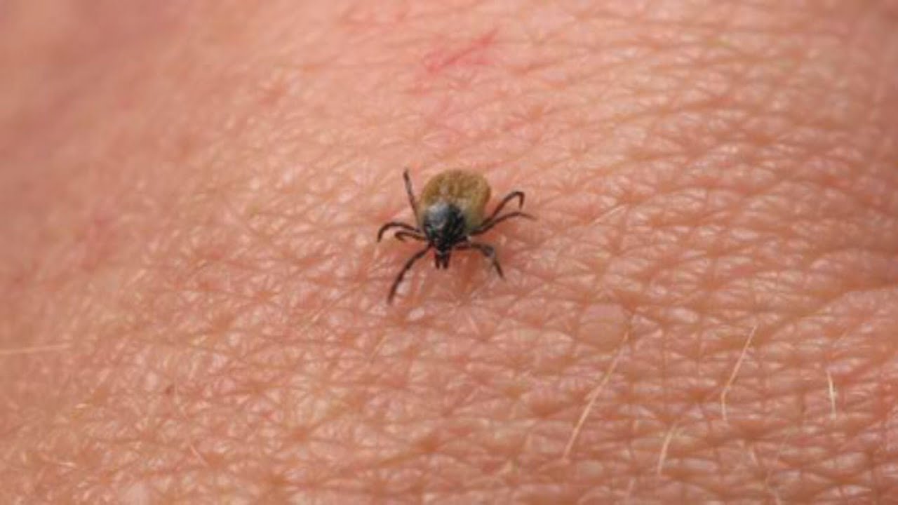 Medicul Virgil Musta explică cum se scoate o căpușă și care sunt riscurile de infectare cu boala Lyme