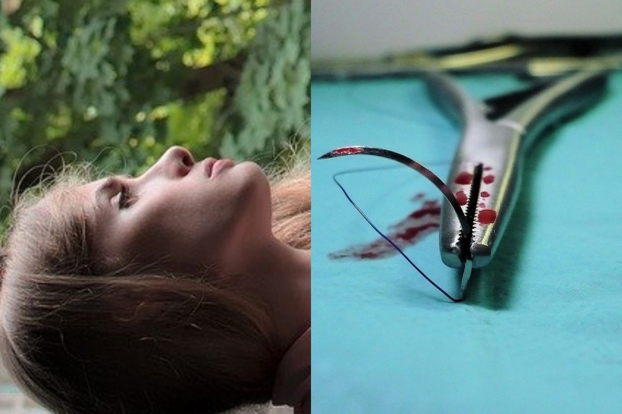 Femei desfigurate după operații estetice făcute „pe genunchi”: „Stai liniștită, am mutilat și pe altele, nu doar pe tine”
