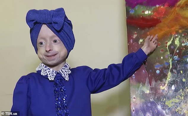 La 10 ani, arăta ca de 80. Cine a fost Benjamin Button în viața reală și boala rară de care suferea