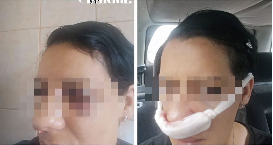 EXCLUSIV. Mărturia cutremurătoare a femeii mutilate de vecinul din bloc: „Îmi pune mesaje pe preș că țiganii trebuie să moară”