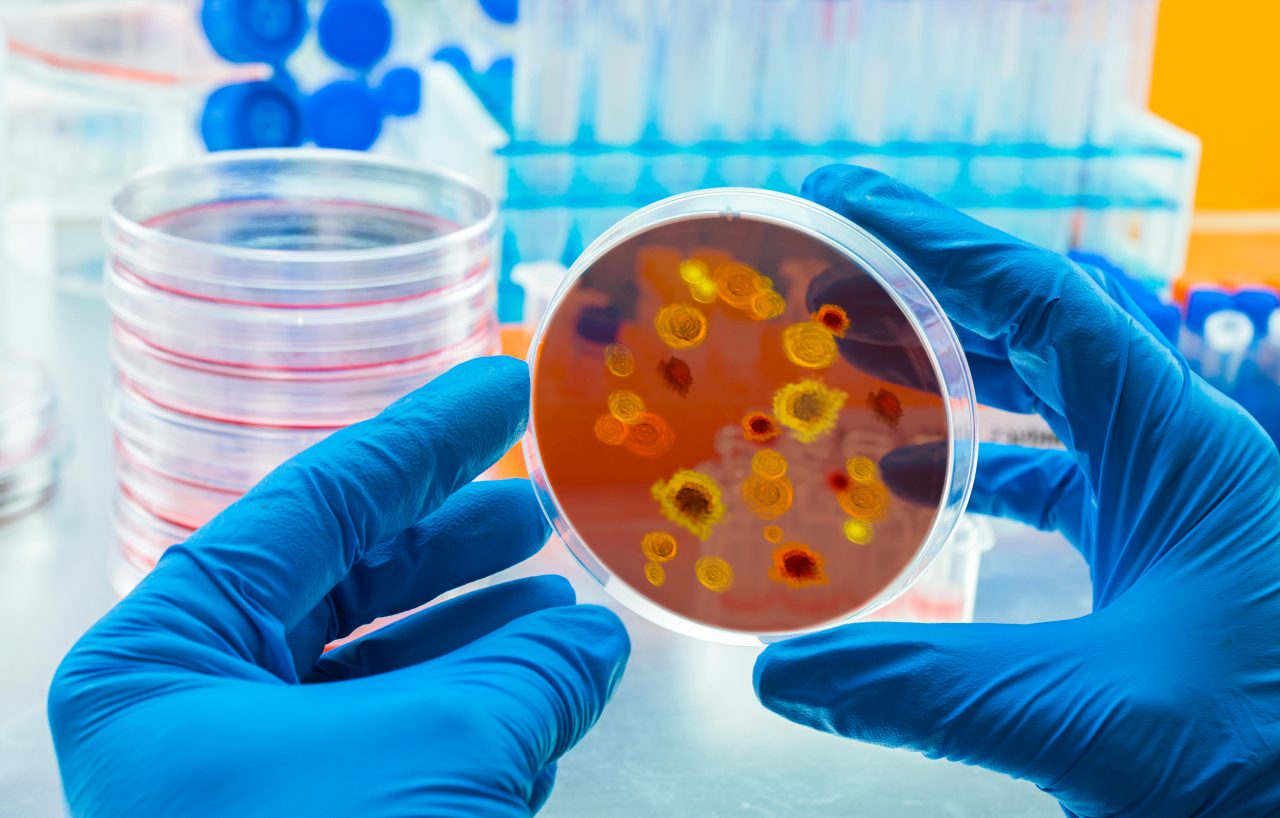 Nouă alertă epidemiologică în Europa: Crește numărul cazurilor de infectare cu „variola maimuțelor”. Portugalia, Spania și Marea Britanie au identificat zeci de cazuri