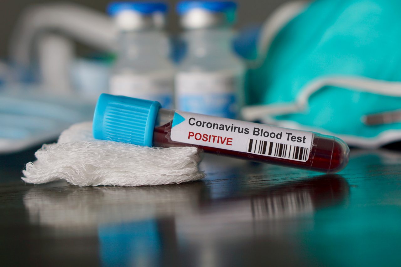 Bilanț coronavirus 18 august. 541 de cazuri de COVID în ultimele 24 de ore