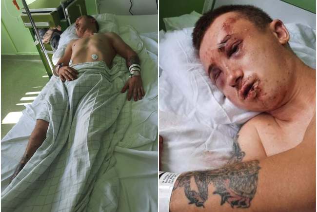 Un tânăr din Arad, la un pas de moarte. A fost bătut cu bestialitate, dezbracat și abandonat pe un trotuar