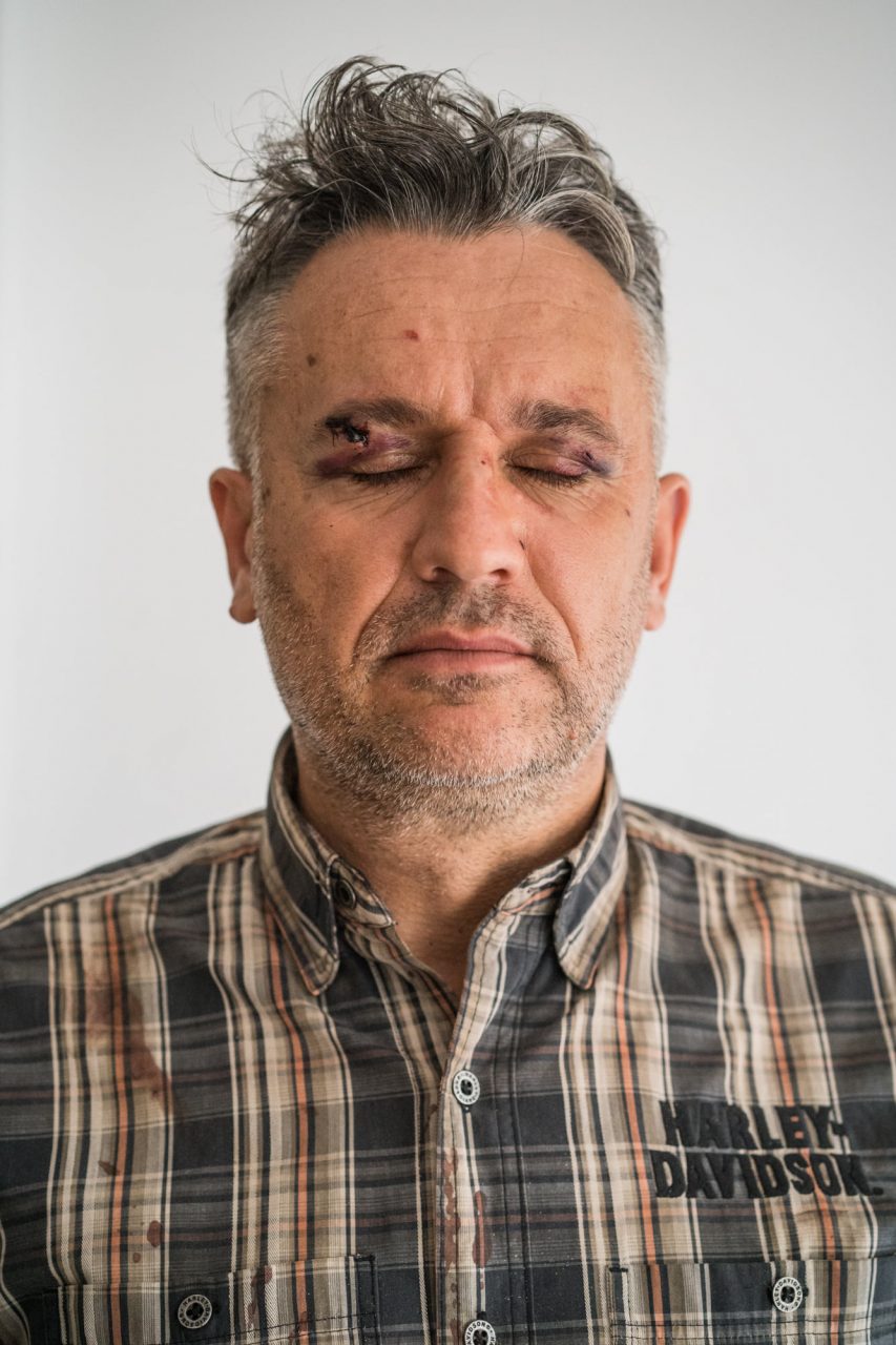 Au fost reținuți patru dintre indivizii care au bătut cu bestialitate doi jurnaliști și un activist de mediu