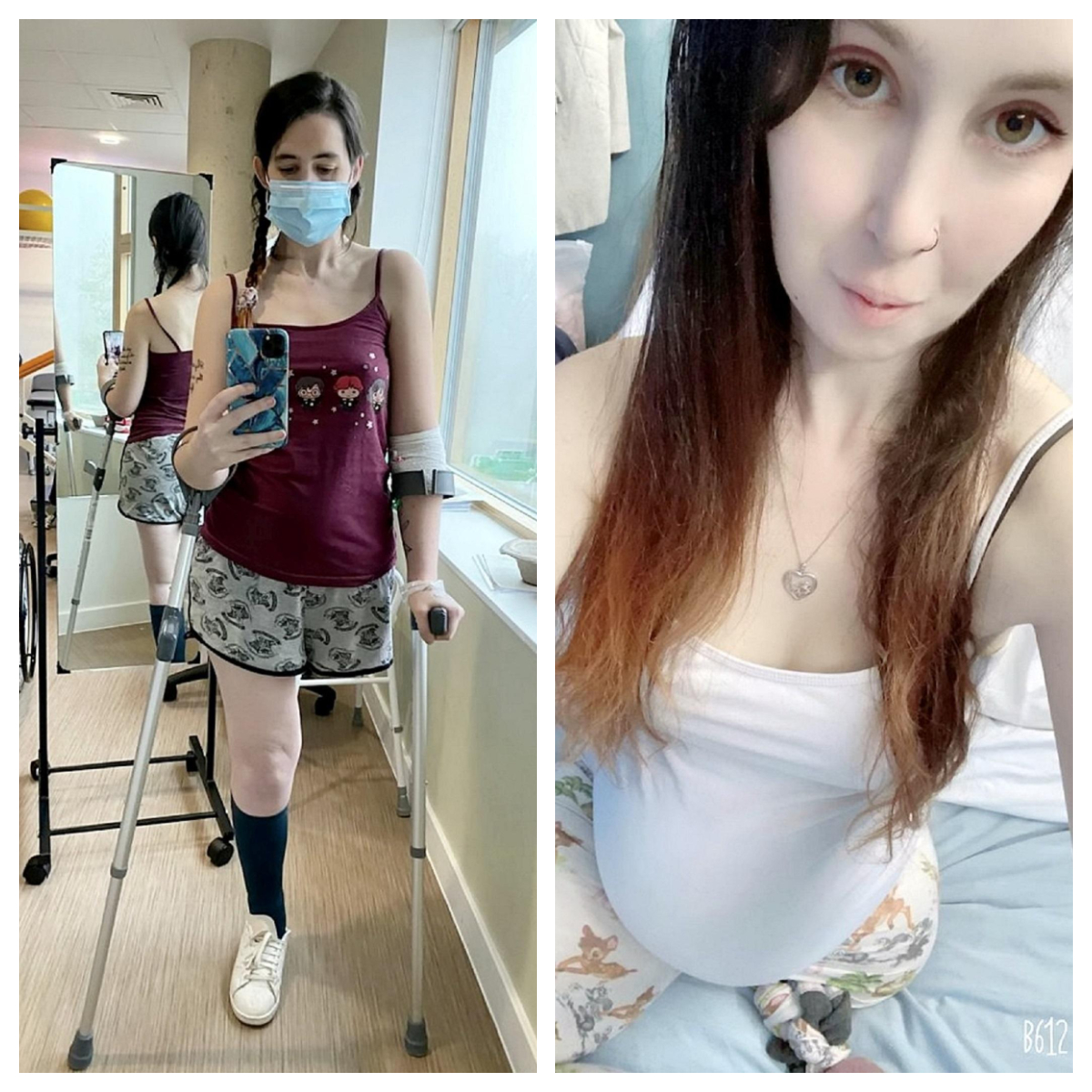 Gestul emoționant pe care l-a facut o mamă bolnavă de cancer. Și-a amputat piciorul pentru a salva viaţa copilului nenăscut