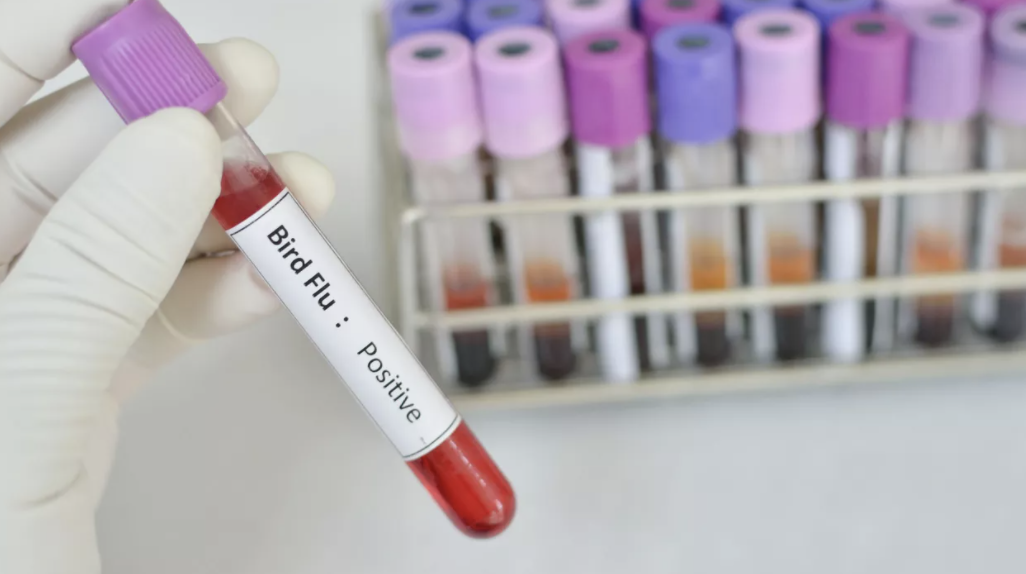 ALERTĂ sanitară! A apărut primul caz de transmitere a virusului gripei aviare de la păsări la om din ultimii 10 ani. O fetiță de 11 ani din Cambodgia a murit