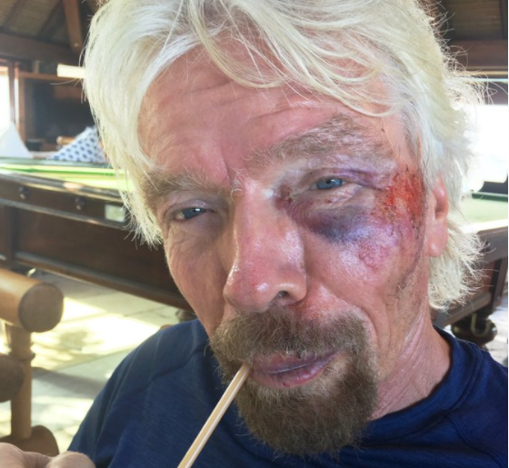 Miliardarul Richard Branson a suferit mai multe leziuni corporale în urma unui accident de bicicletă în Insulele Virgine Britanice