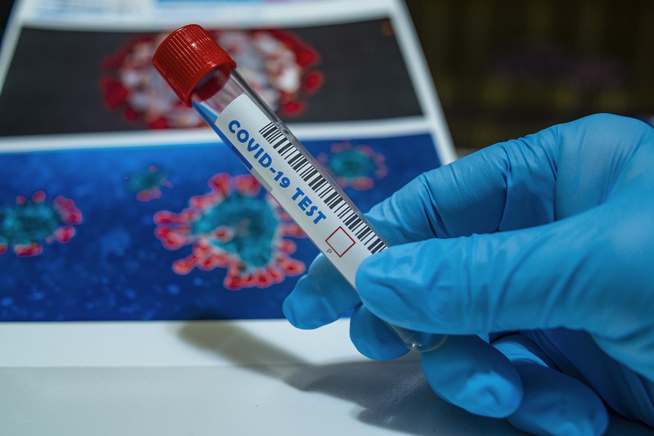 Bilanț coronavirus 2 decembrie: Numărul noilor infectați scade la 1.149, iar cel al deceselor la 66