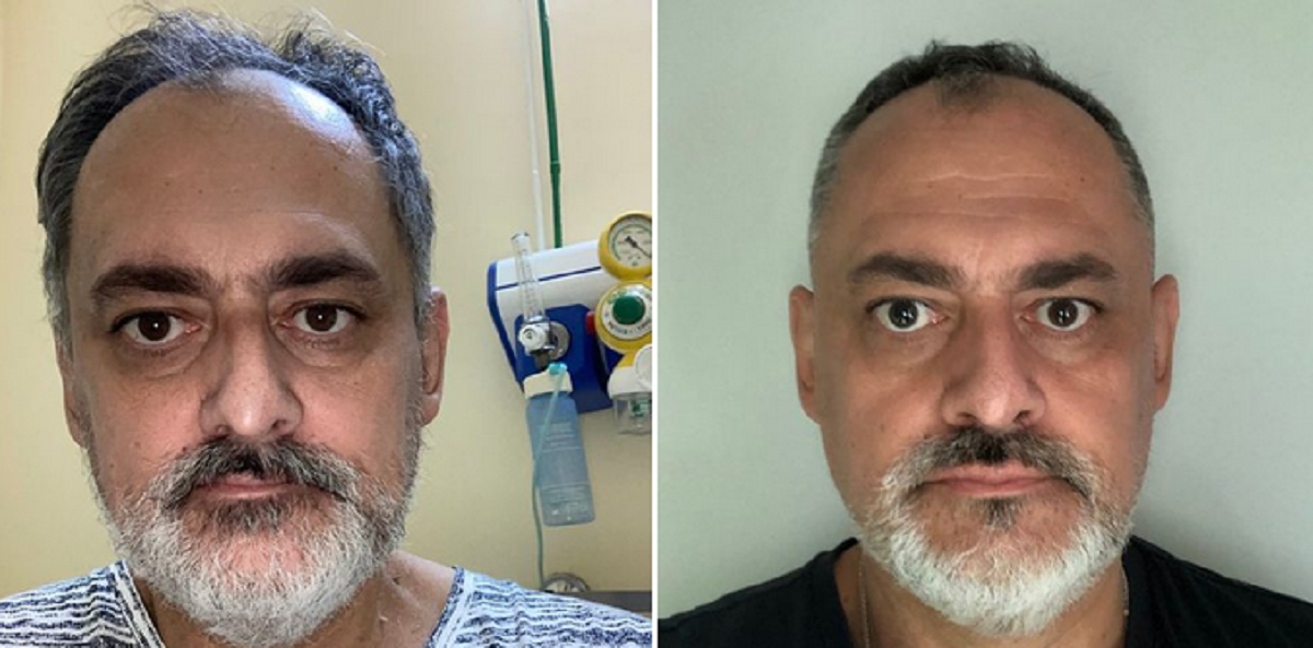 Povestea unui român bolnav de Covid, care a fost internat un an în spital și a rămas cu sechele pentru tot restul vieții: „Nu este o simplă răceală, nu este un complot mondial”