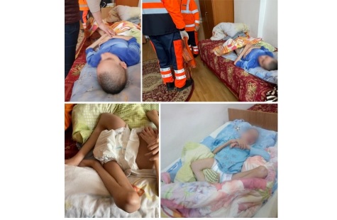 Caz șocant în Vâlcea. Georgiana, o tânără cu dizabilități, malnutrită, a fost ținută cu piciorul rupt timp de patru luni