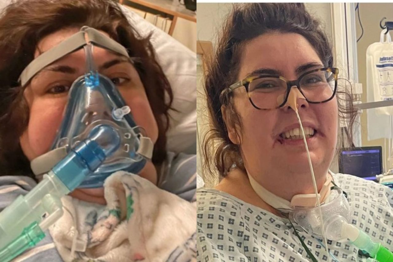 Monica, o asistentă medicală infectată cu COVID, nu mai avea nicio șansă de supraviețuire. Tânăra a fost salvată de colegi, care i-au administrat Viagra