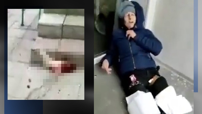 VIDEO | O femeie a rămas fără picioare din cauza unei rachete rusești. Atenție, IMAGINI ȘOCANTE din Harkov!