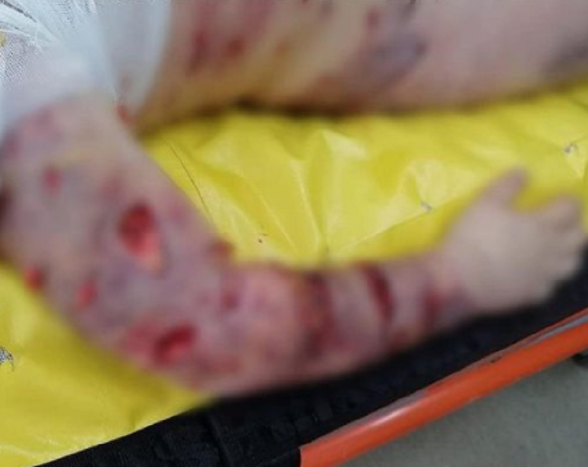 „Au rupt bucăți din el și are coșmaruri”. Povestea tulburătoare a lui Aron, băiețelul de 10 ani sfâșiat de o haită câini, în timp ce venea de la școală