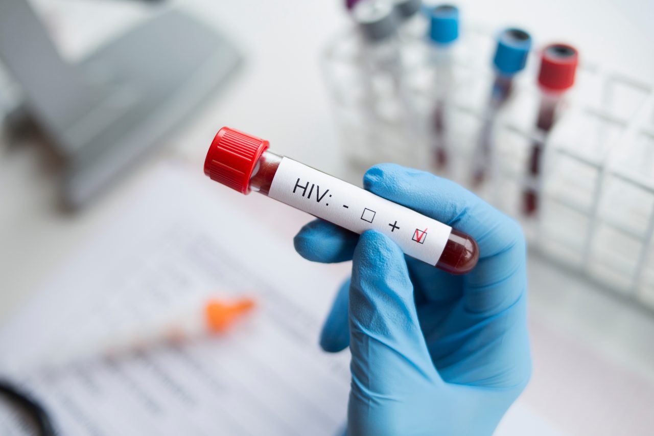 Un bărbat s-a vindecat de HIV după ce a primit tratament pentru leucemie. Medicii spun că e doar al patrulea caz de acest fel
