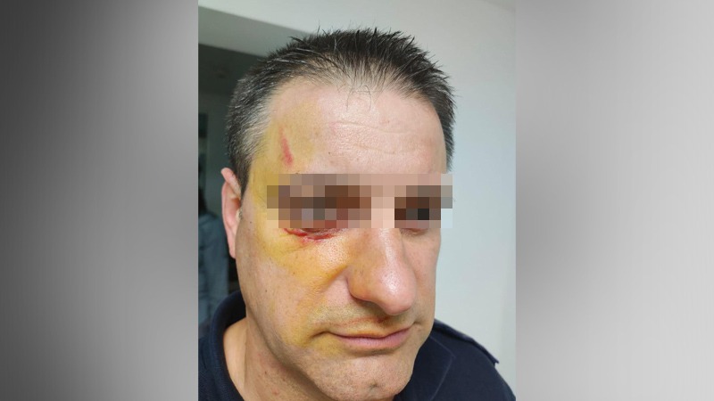 Polițist atacat de un refugiat într-un centru de cazare pentru imigranți. Ofițerul a avut nevoie de intrevenția medicilor