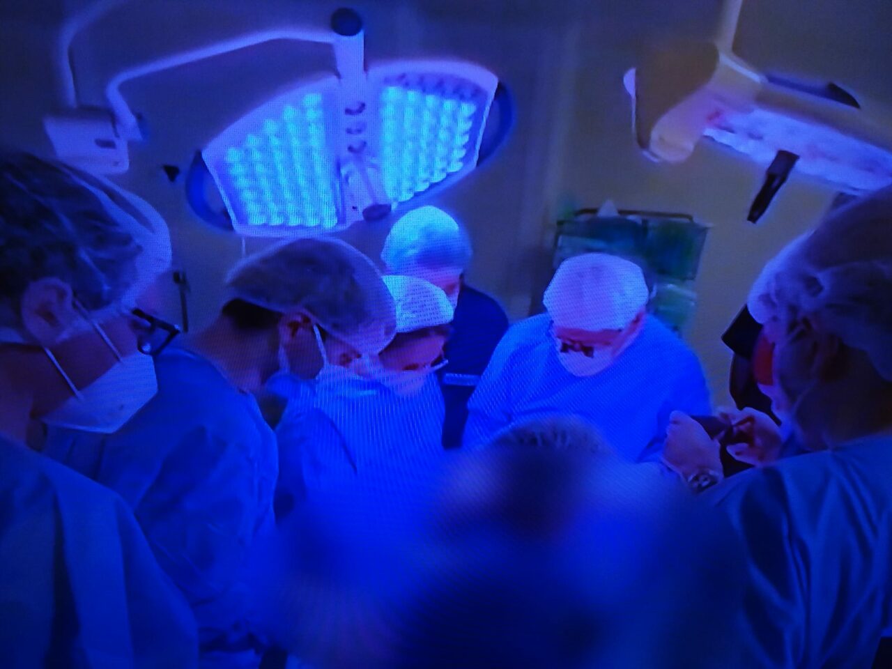Transplantul hepatic al fetiței de 5 ani, primul caz semnalat cu hepatită misterioasă, a fost realizat cu succes. Operația, la care au participat 17 medici, a durat cinci ore