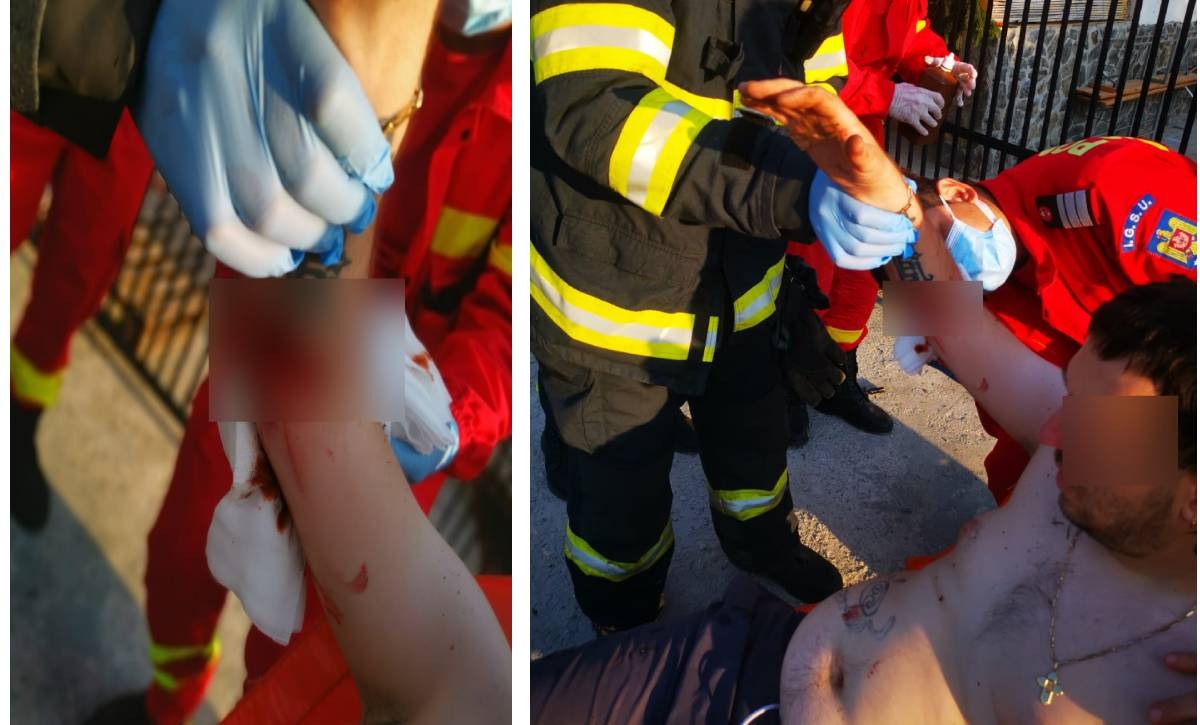 FOTO | Accident teribil chiar înainte de nuntă. Un mire din Râmnicu-Vâlcea a rămas cu mâna înfiptă în țepii unei porți