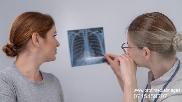 Focar misterios de pneumonie într-un oraș din Argentina. A fost identificată bacteria care a ucis șase oameni într-o săptămână