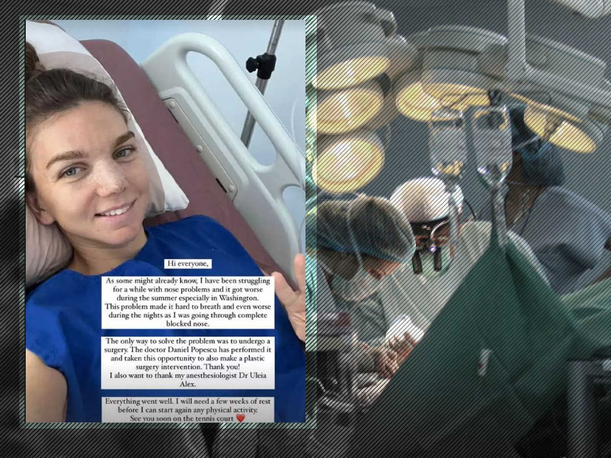 FOTO – Simona Halep s-a operat la nas, după mai multe probleme medicale care s-au agravat: „Intervenția chirurgicală a decurs foarte bine” / Sportiva s-a fotografiat pe patul de spital