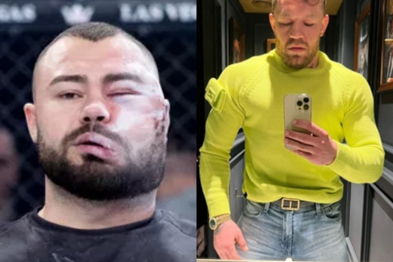 Conor McGregor, mesaj pentru românul care s-a lăsat desfigurat pentru 5.000 de euro. Cum se simte acum Sorin Comșa, campionul concursului de dat palme