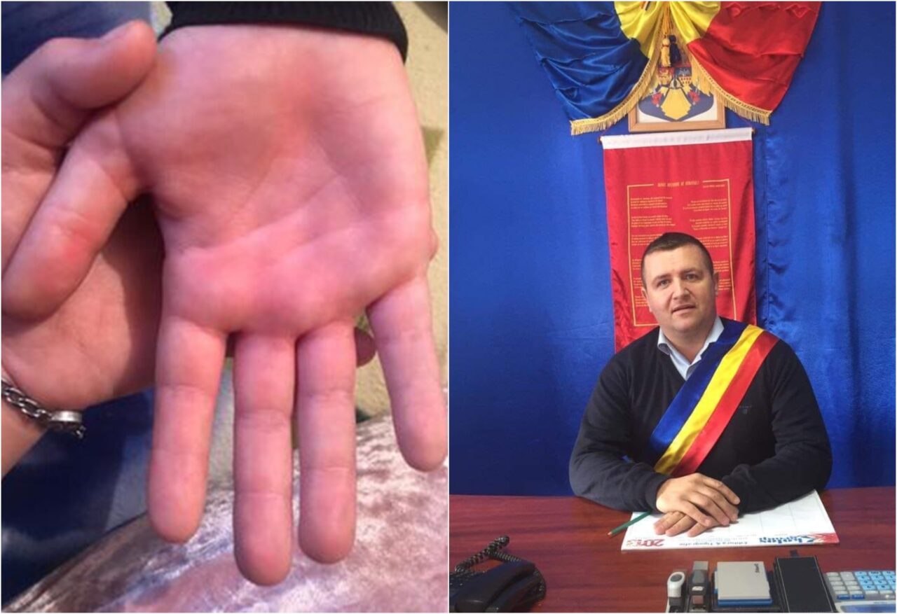Detalii șocante în cazul învățătorului care a bătut un copil. Un primar din Vaslui îi ia apărarea: ”Dacă l-aș vedea, i-aș strânge mâna”