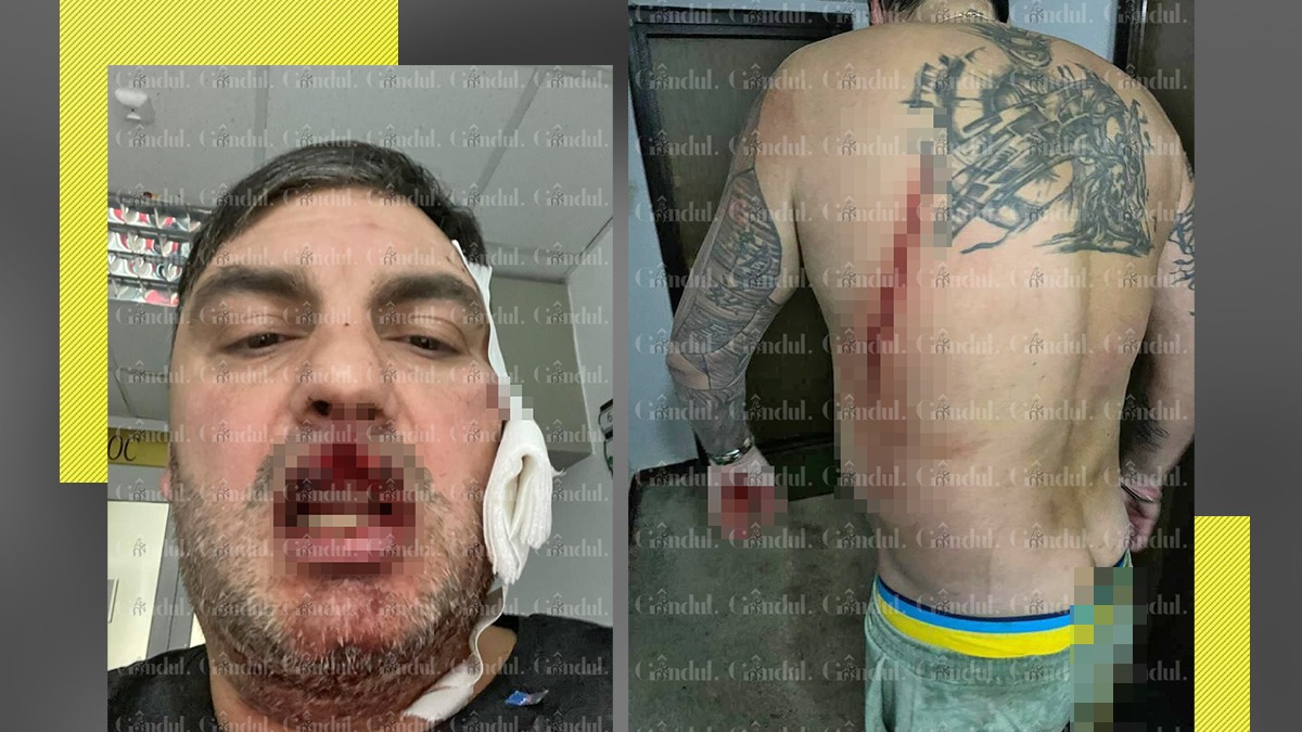 FOTO ȘOCANT. Bătaie ca în filme la Constanța. Doi interlopi „aspiranți” s-au certat din nimic. Unul a ajuns la spital, tăiat pe spate